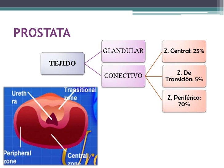 fisiopatologia de la prostatitis